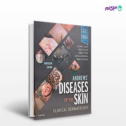 تصویر  کتاب Andrews' Diseases of the Skin نوشته William D. James, Dirk Elston, James R. Treat, Misha A. Rosenbach, Robert G. Micheletti از انتشارات اطمینان