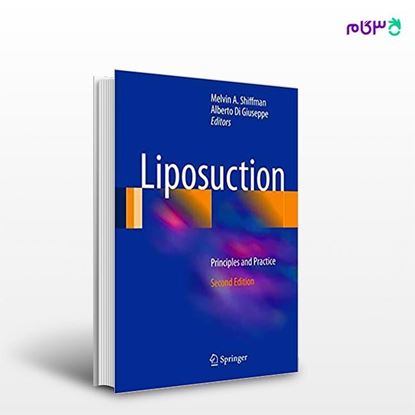 تصویر  کتاب Liposuction: Principles and Practice نوشته Melvin A. Shiffman, Alberto Di Giuseppe از انتشارات اطمینان